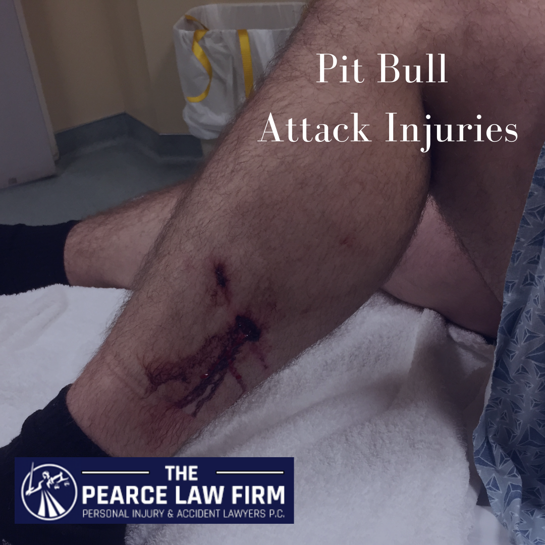 The Pearce Law Firm Pit Bull Attack Injuries